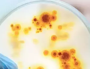 Análise microbiológica